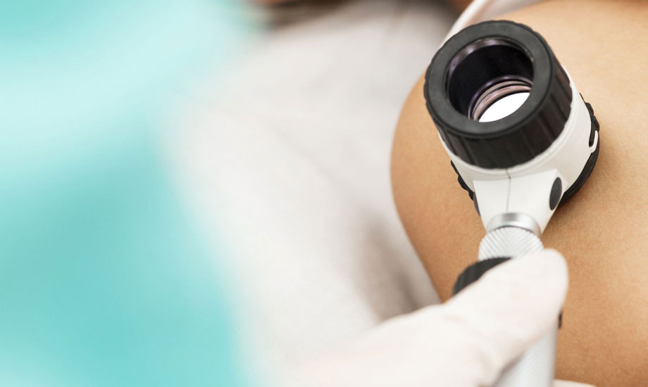 Skin Cancer Check And Dermatoscopy Vitality Healthcare Medical Centre