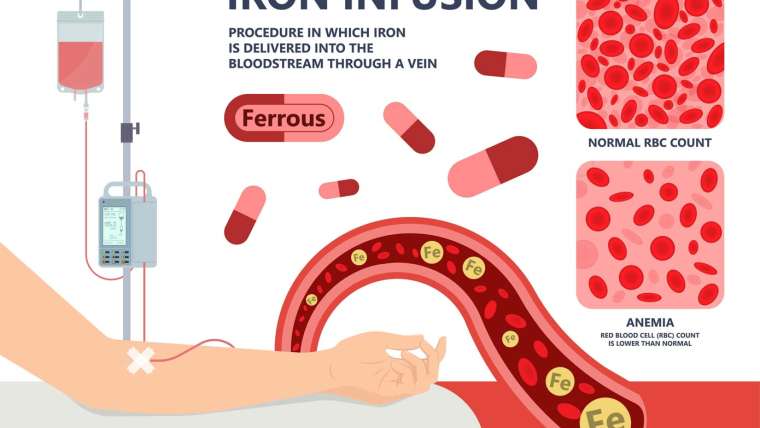 Iron Infusion